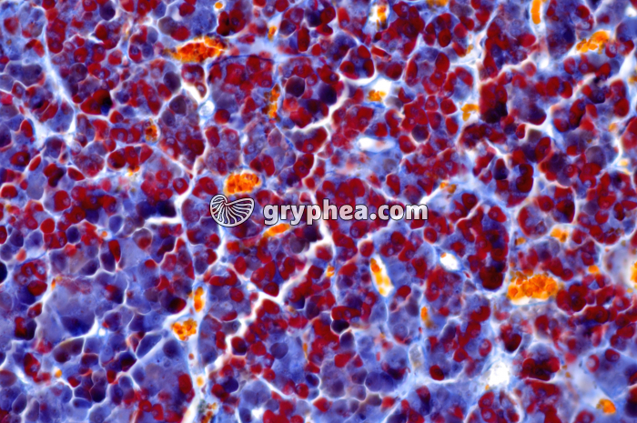 Hypophyse antérieure x100 - gryphea.com